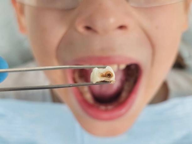 Best Weekend Emergency Dentist in Lone Star, TX