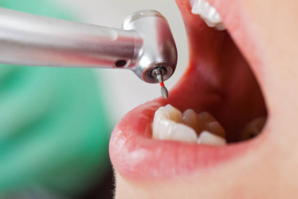 Best Pediatric Emergency Dentist in Lone Star, TX